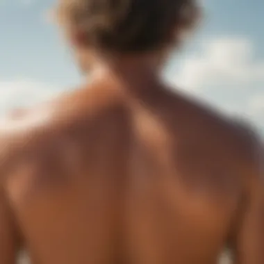 Close-up of a sunburnt back after a day of surfing